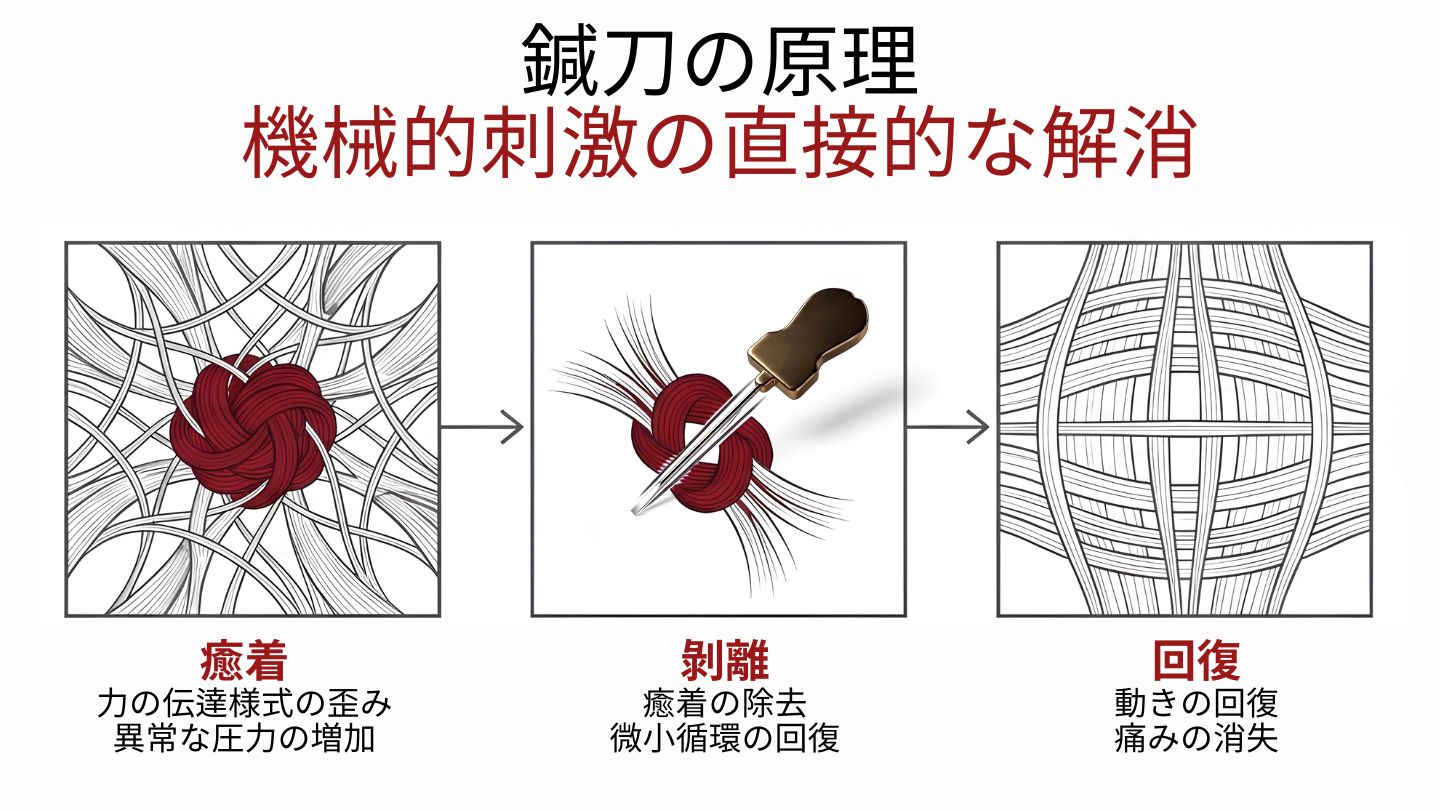 鍼刀の役割：機械的刺激の直接的な解消 — 癒着・剝離・回復の3段階