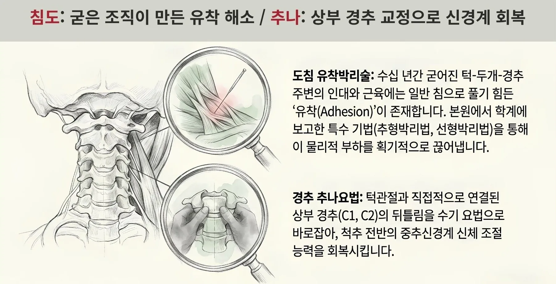 침도(도침)로 수십 년 굳은 턱–두개–경추 주변 유착(Adhesion)을 박리하고, 경추 추나요법으로 상부 경추(C1·C2) 뒤틀림을 바로잡아 신경계를 회복하는 원리 도식