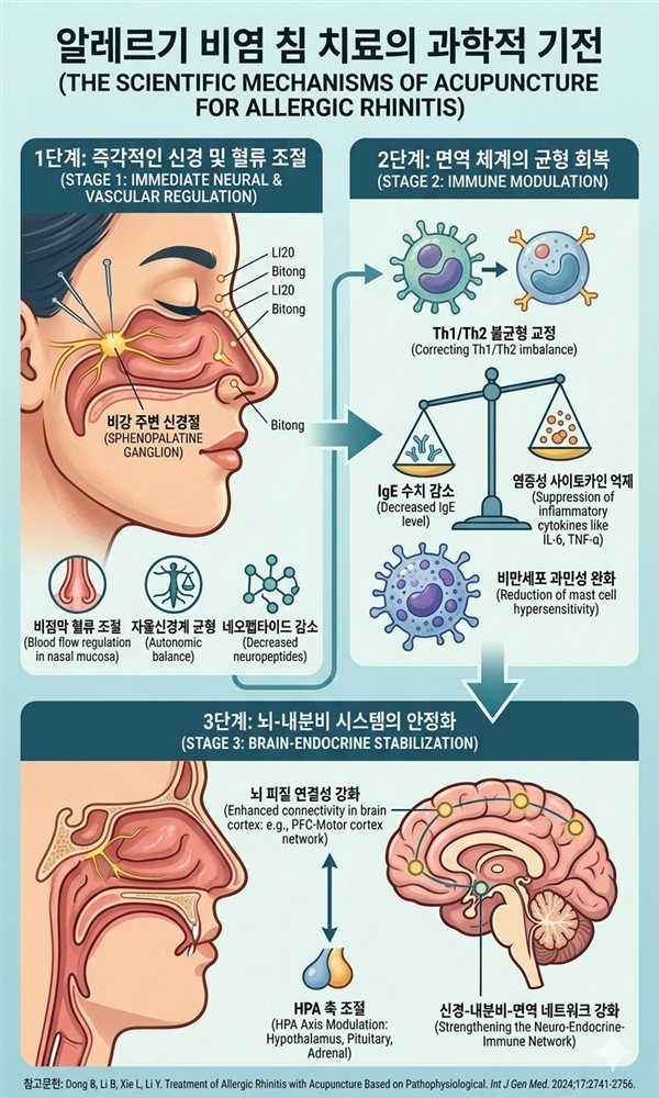 논문이 말하는 비염의 침치료 효과