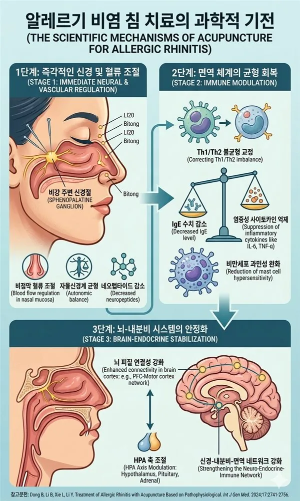 논문이 말하는 비염의 침치료 효과