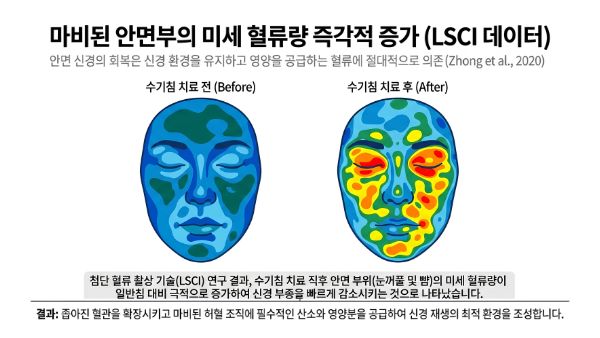 후유증을 회복시키는 침치료