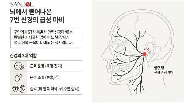 구안와사 왜 생길까?