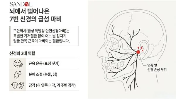 구안와사 왜 생길까?