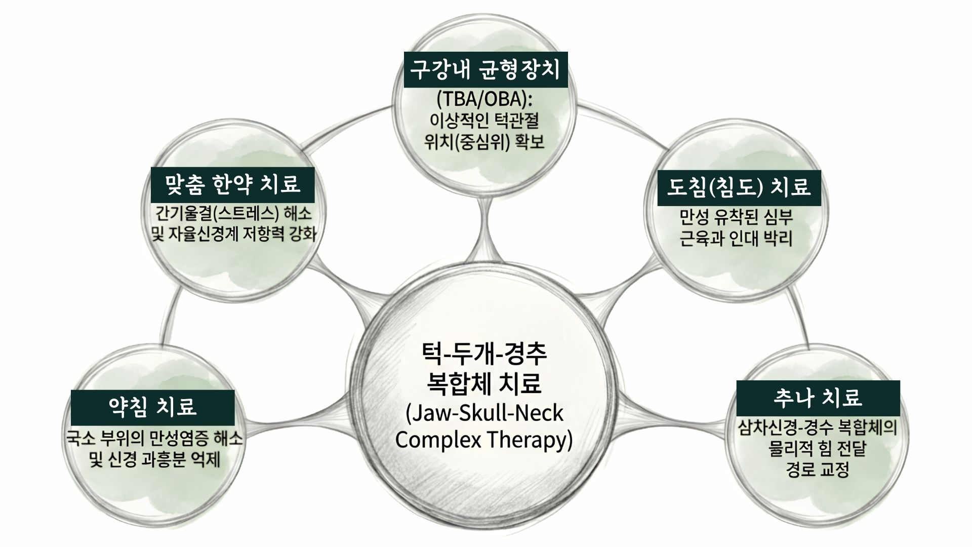 턱-두개-경추 복합체 치료(Jaw-Skull-Neck Complex Therapy)를 중심으로 구강내 균형장치(TBA/OBA)·도침(침도)·추나·약침·맞춤 한약 치료가 둘러싼 산돌의 복합 치료 구성도