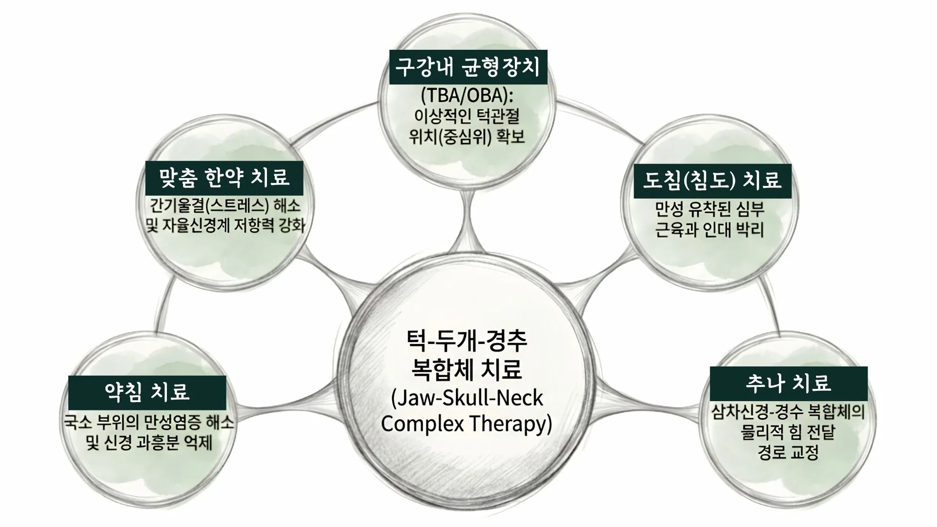 턱-두개-경추 복합체 치료(Jaw-Skull-Neck Complex Therapy)를 중심으로 구강내 균형장치(TBA/OBA)·도침(침도)·추나·약침·맞춤 한약 치료가 둘러싼 산돌의 복합 치료 구성도