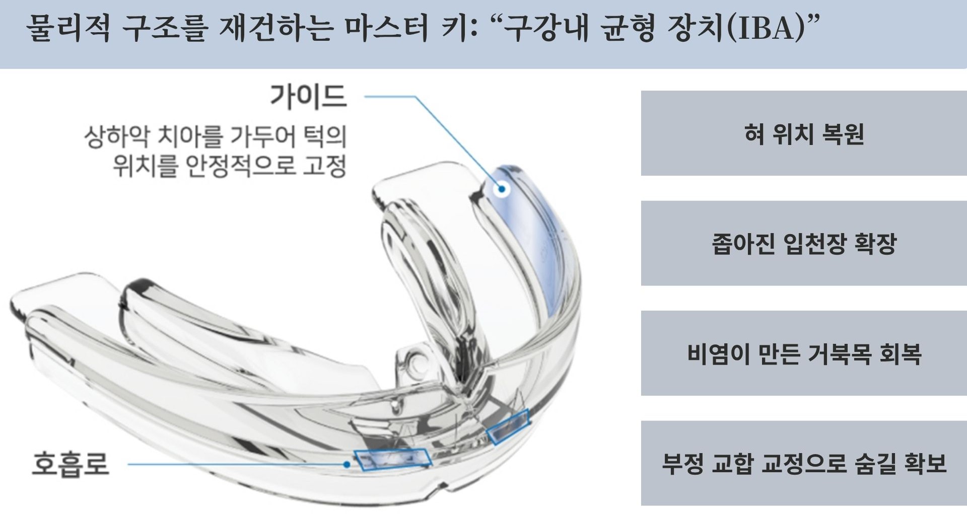 IBA를 통한 구강·비강 구조 정렬 원리 도식