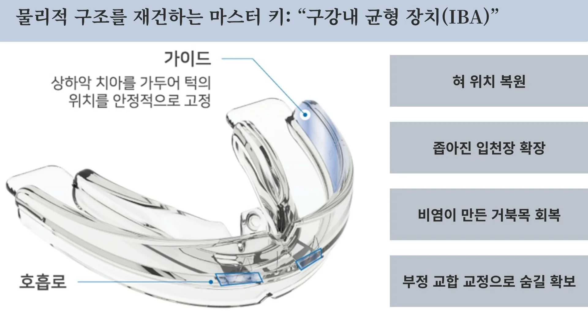IBA를 통한 구강·비강 구조 정렬 원리 도식