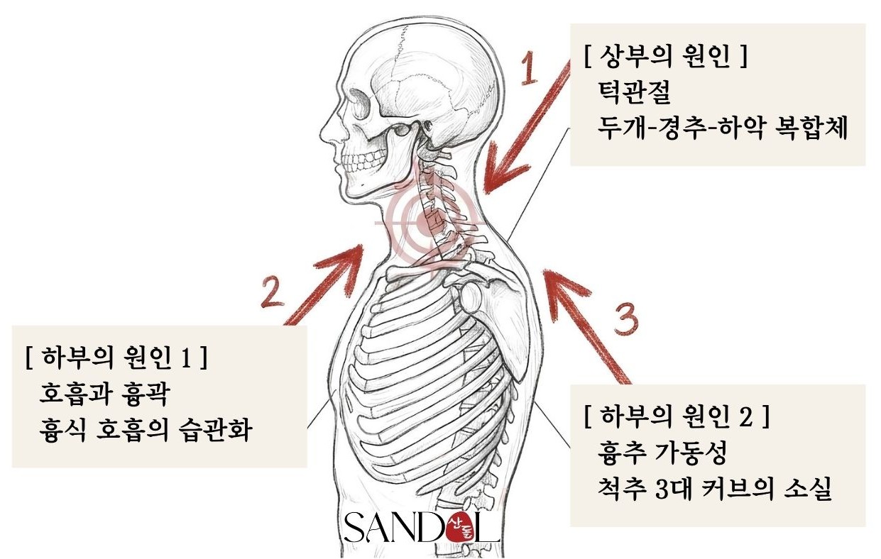 목을 아프게 하는 3가지 원인