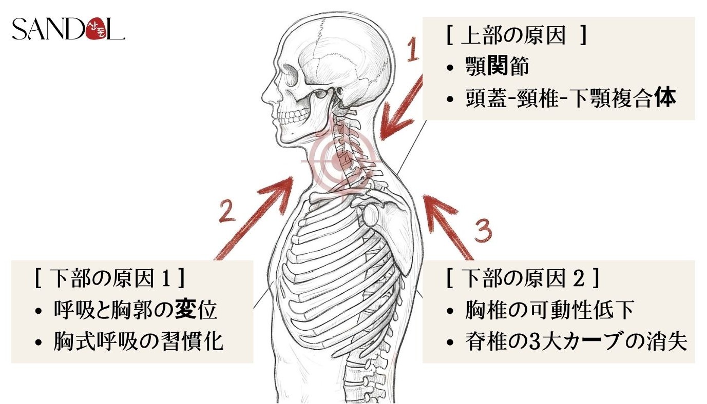 首の痛みの3つの原因