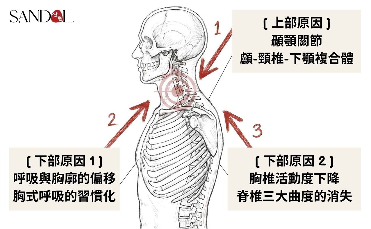 使頸部疼痛的 3 種原因
