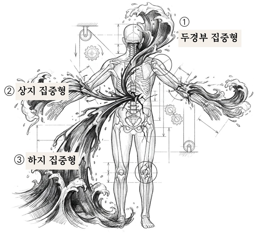 댐이 무너져 물이 범람하듯 통증이 전신으로 번지는 모습