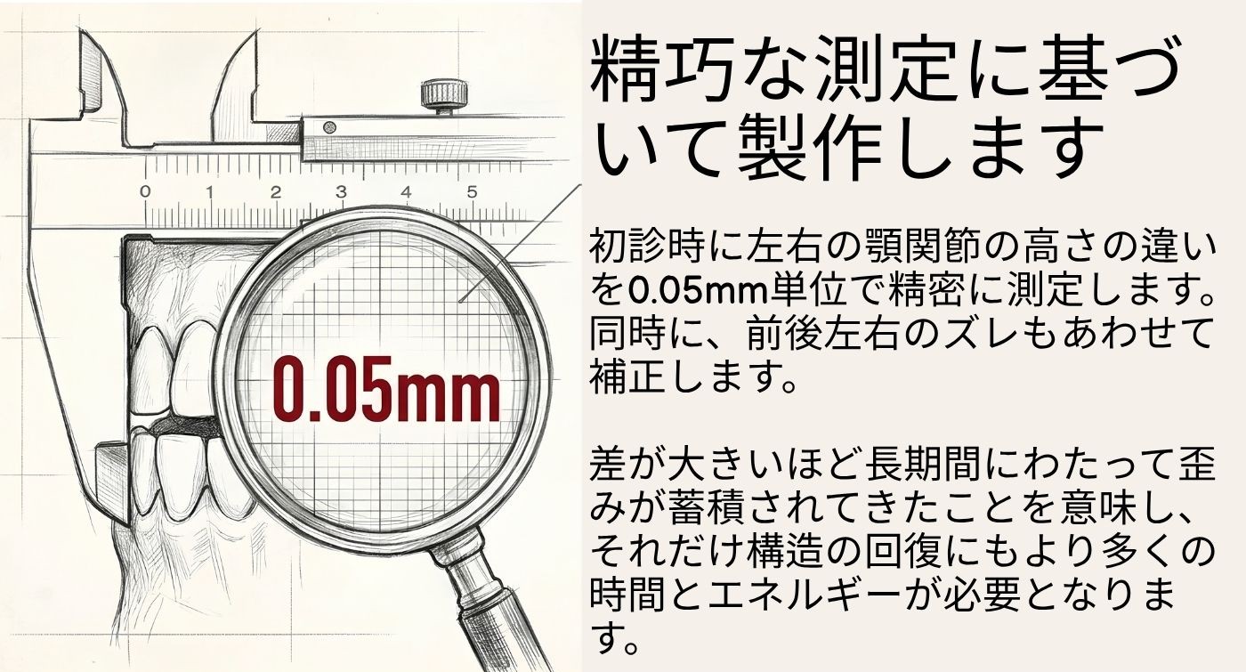 オーダーメイド治療1 — 精密に測定して製作