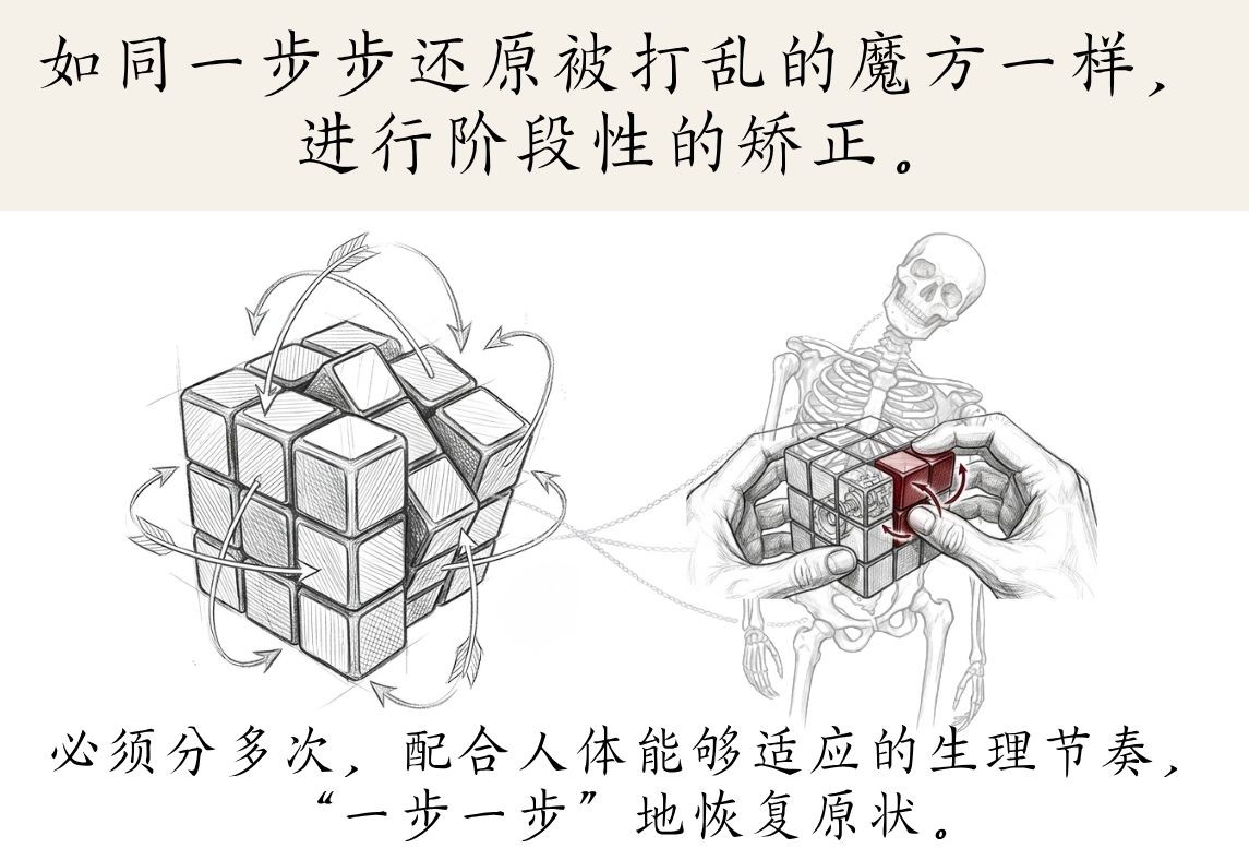 客制化治疗 2——如拼魔术方块般反复校正